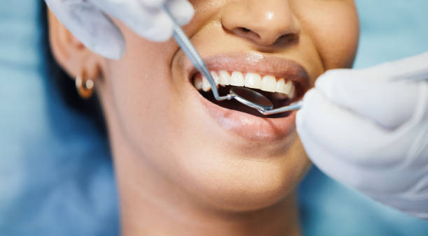 Best Emergency Tooth Extraction in Hampstead, NC