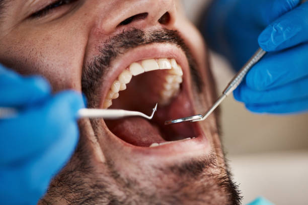 Best Weekend Emergency Dentist in Hampstead, NC